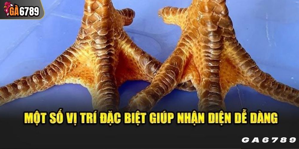 Một số vị trí để phát hiện vảy trung huyền